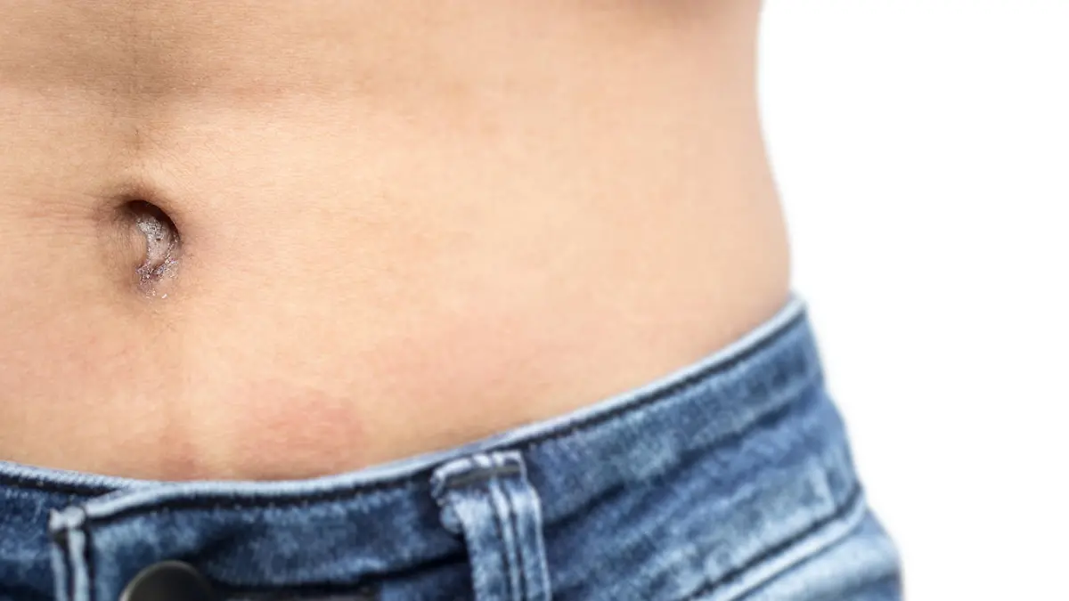 Dreckiger Bauchnabel