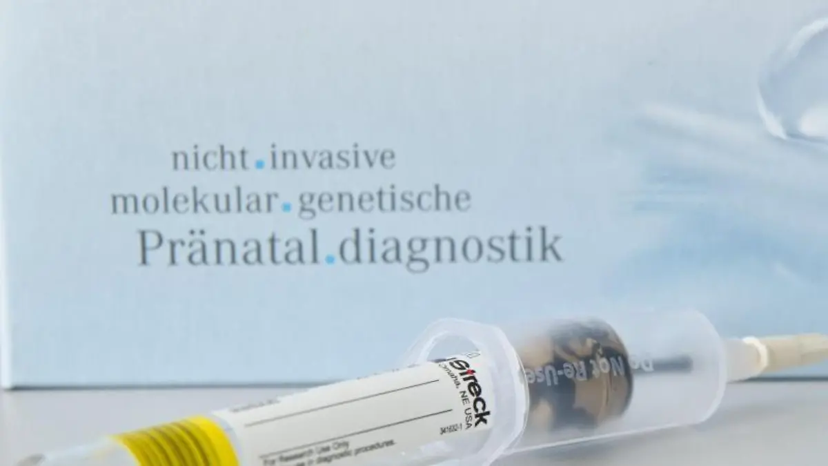 Down-Syndrom-Bluttest