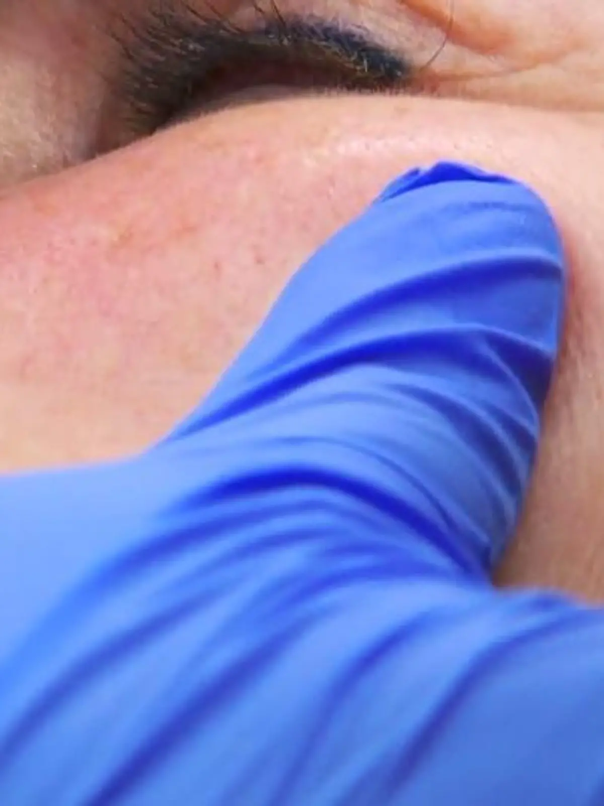 Bild zu: "Dermaplaning: So wirkt der Beautytrend"