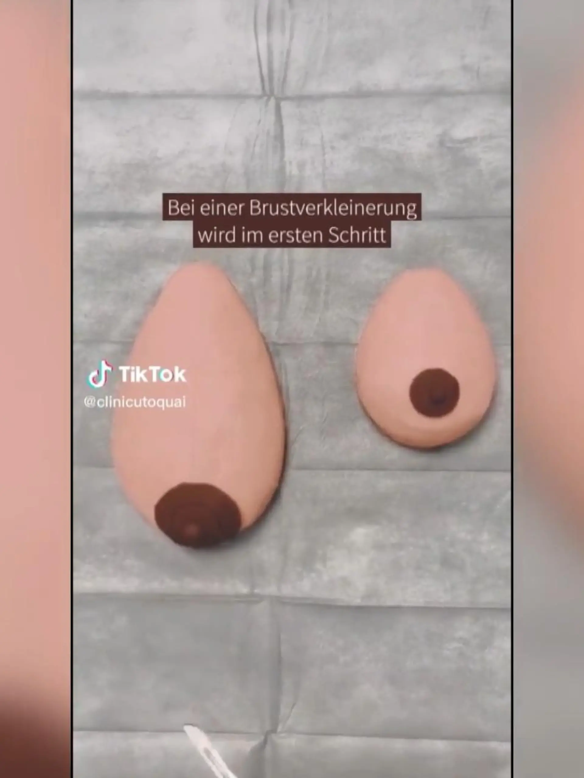 Bild zu: "Kleinere Brust? Video zeigt, wies geht"