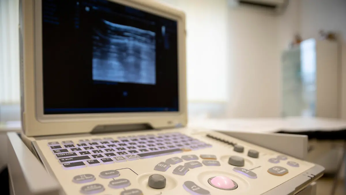 Medical ultrasound equipment. Ultrasound to image the human body.