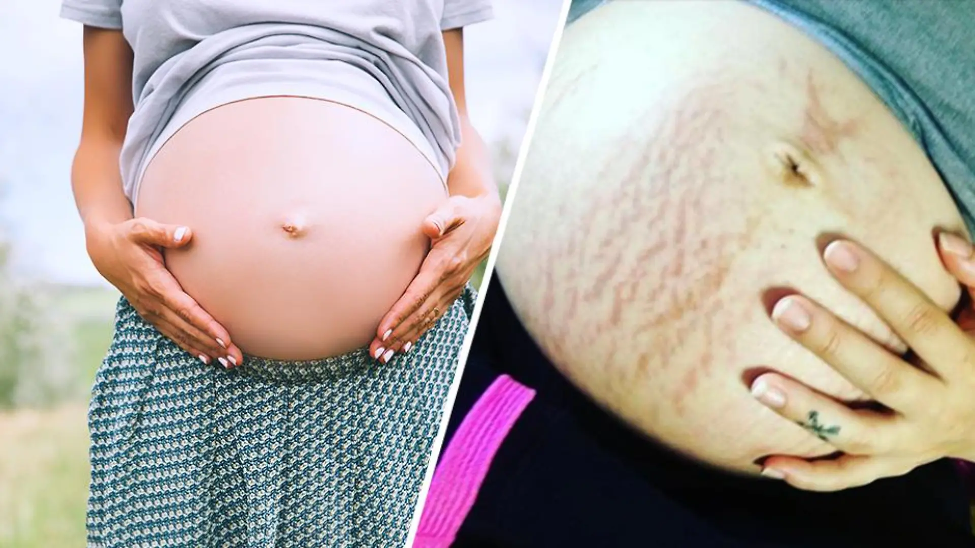 Babybauch