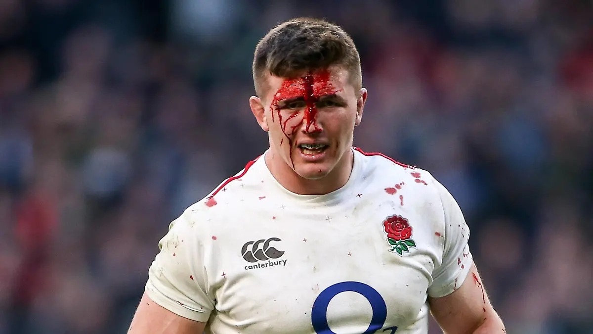 Rugby