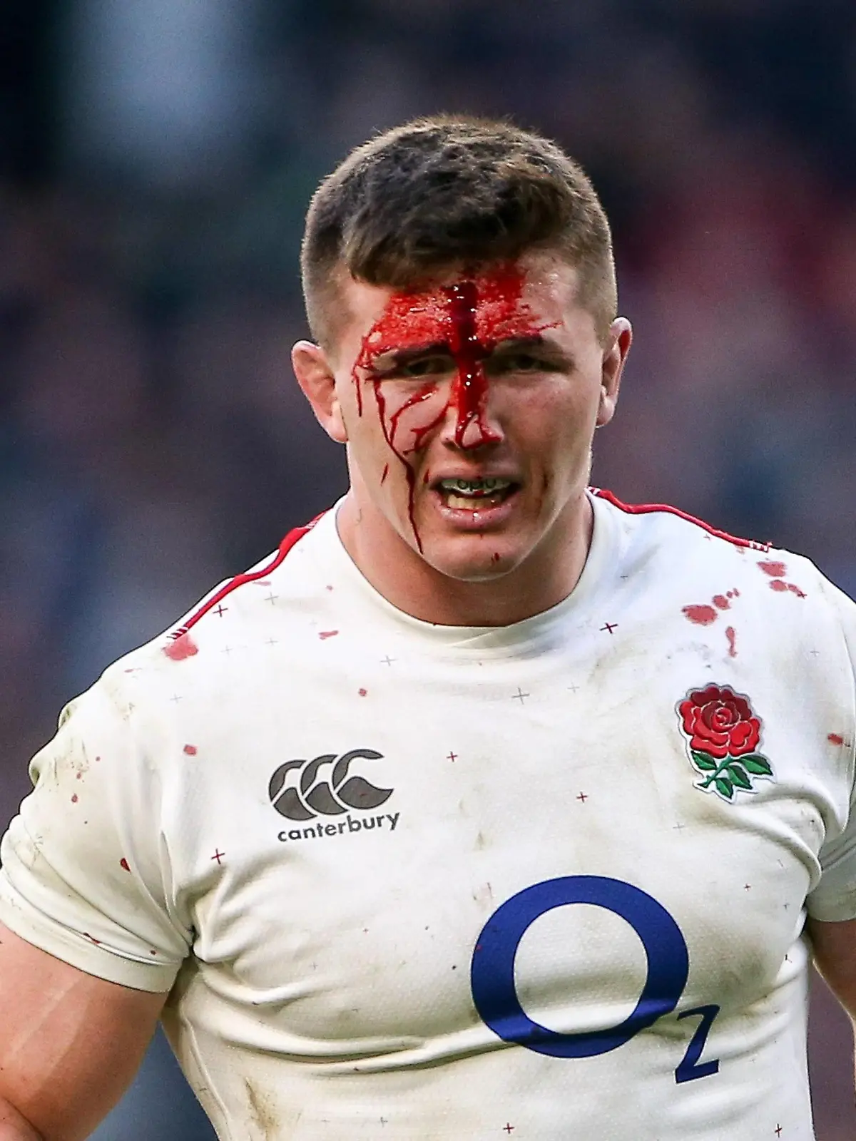 Rugby