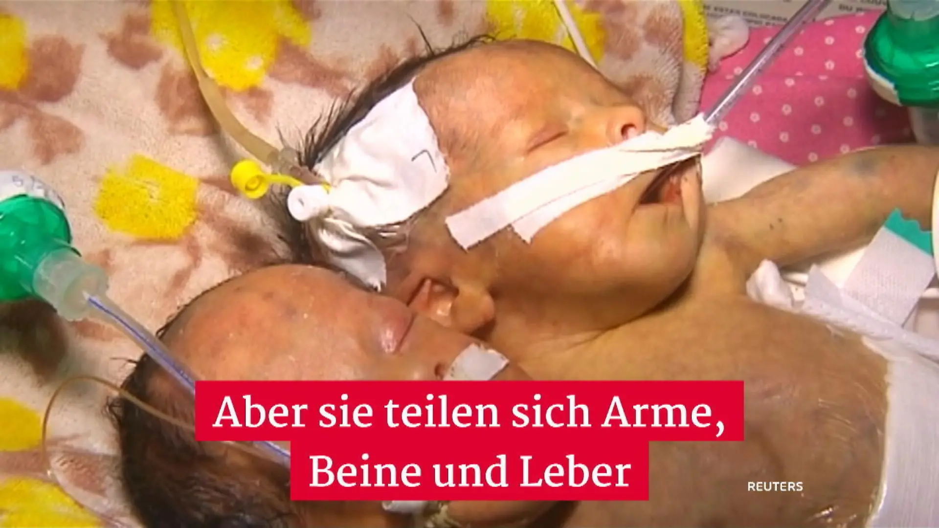 Samesische Zwillinge