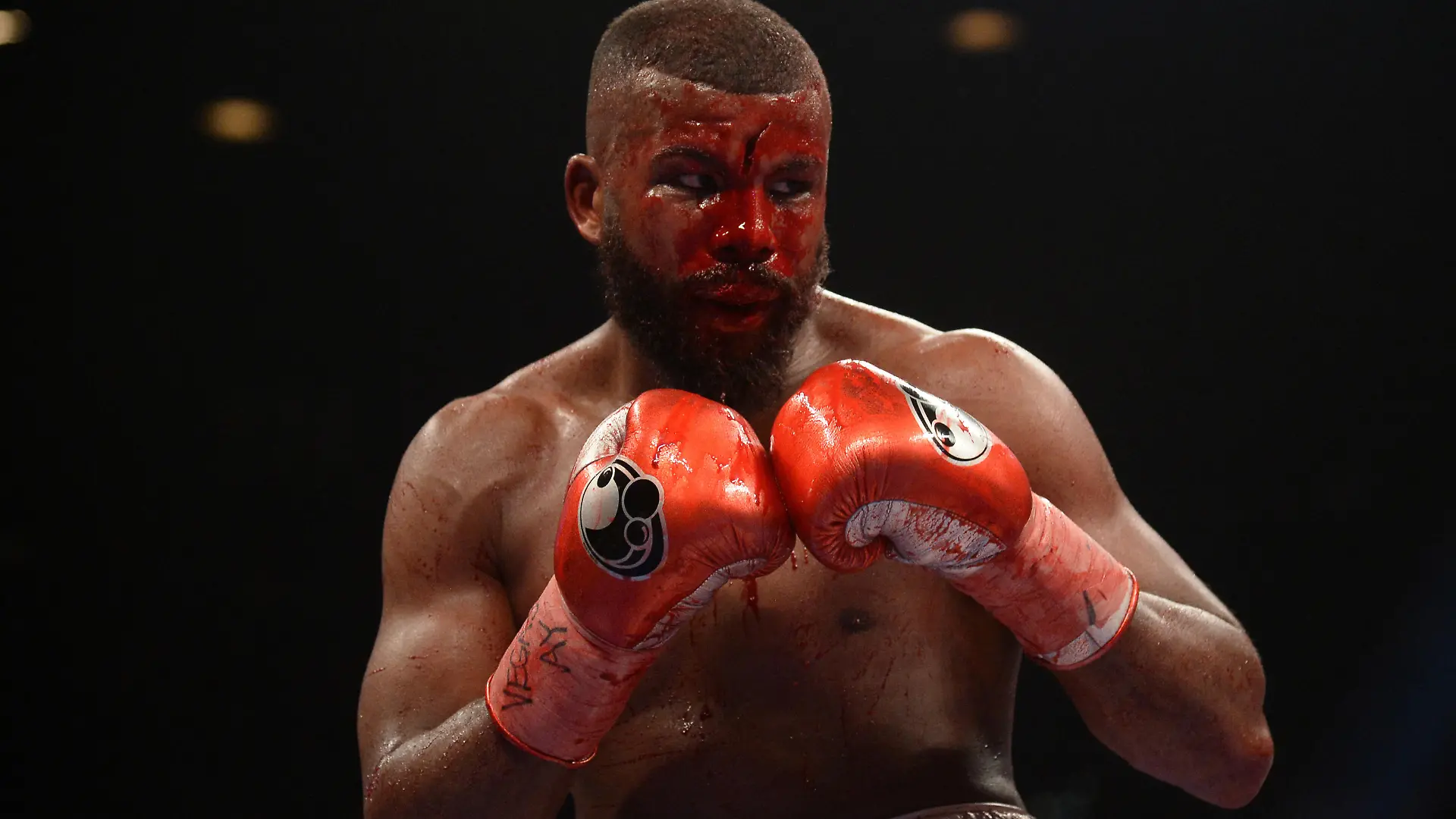 Jan 19, 2019; Las Vegas, NV, USA; Badou Jack reacts to a cut on his forehead during a WBA Interim & WBC Silver light heavyweight boxing match against Marcus Browne (not pictured) at MGM Grand Garden Arena. Browne won via unanimous decision. Mandatory Credit: Joe Camporeale-USA TODAY Sports