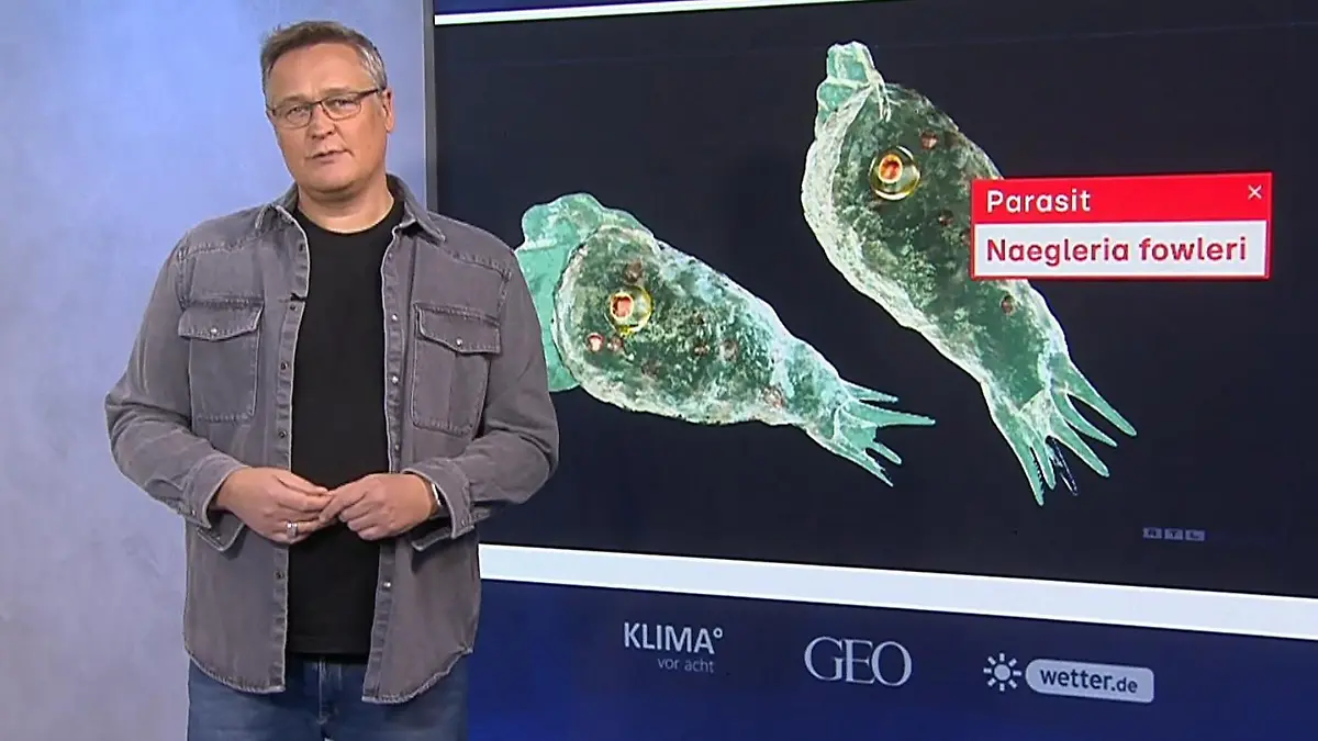 Klimawandel begünstigt Krankheiten und Parasiten Horror-Amöbe breitet sich aus