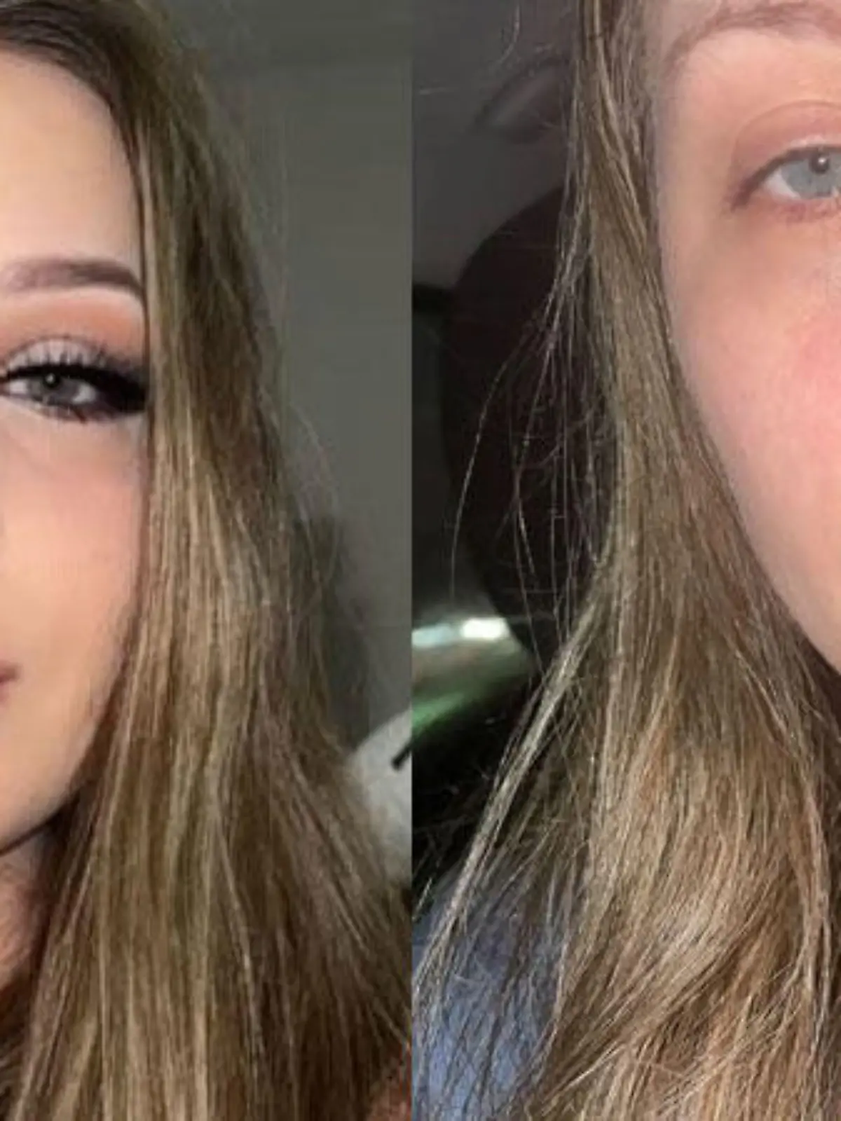 Sie wollte nur ein wenig mehr Fülle für die Lippen. Mutter Natur sah das anders.