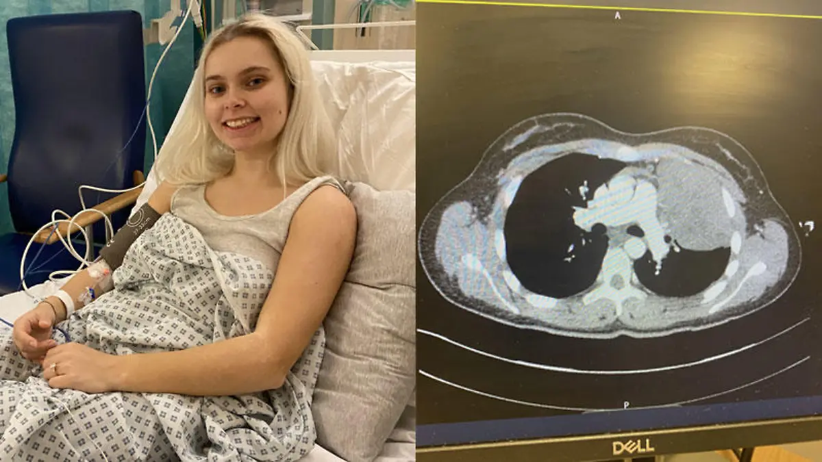 Hannah fordert jetzt alle auf, eine zweite Meinung einzuholen, wenn sie mit der Diagnose der Ärzte nicht zufrieden sind.