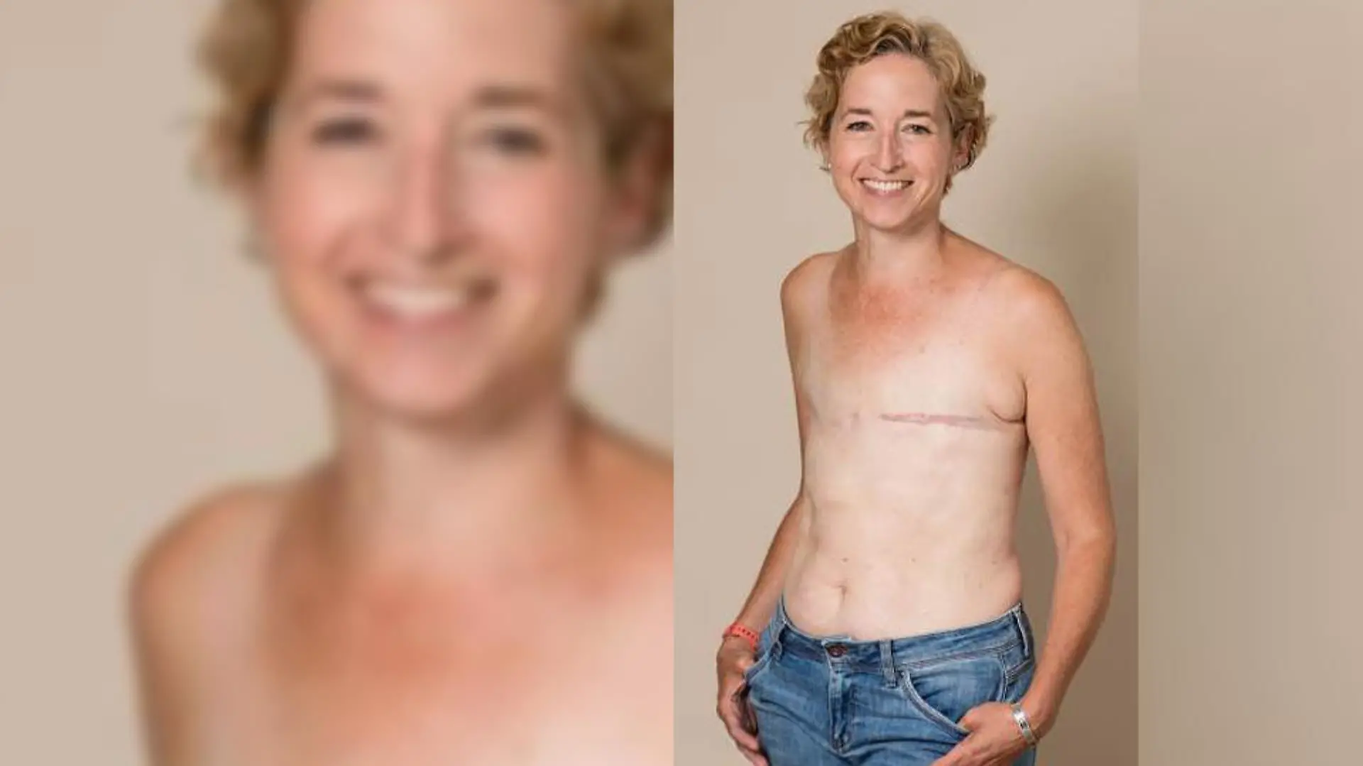 Gemma Cockrell will mit ihren Oben-ohne-Fotos ein realistisches Bild von einem Leben mit Brustkrebs zeigen.
