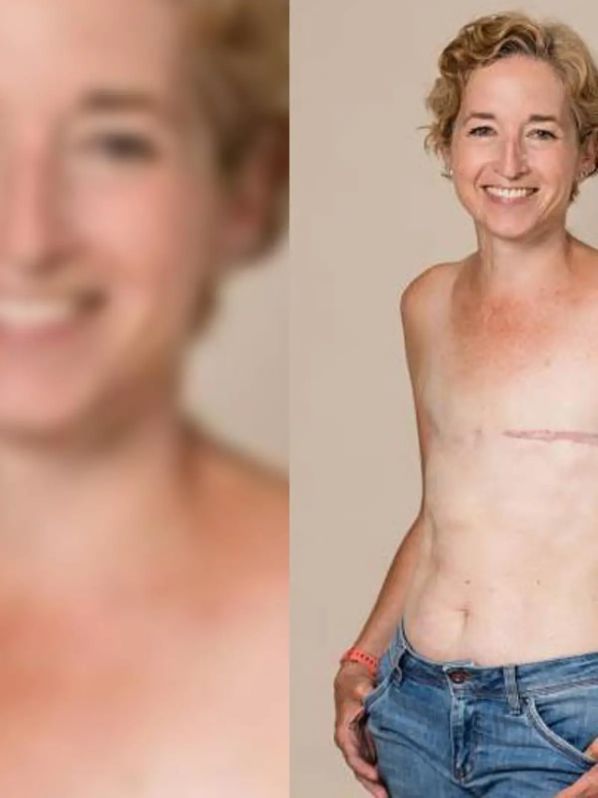 Gemma Cockrell will mit ihren Oben-ohne-Fotos ein realistisches Bild von einem Leben mit Brustkrebs zeigen.