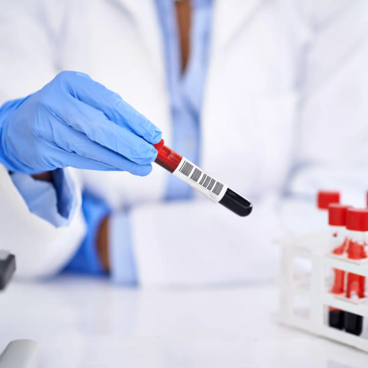 Hämophilie (Bluterkrankheit) Logo von Hämophilie (Bluterkrankheit)