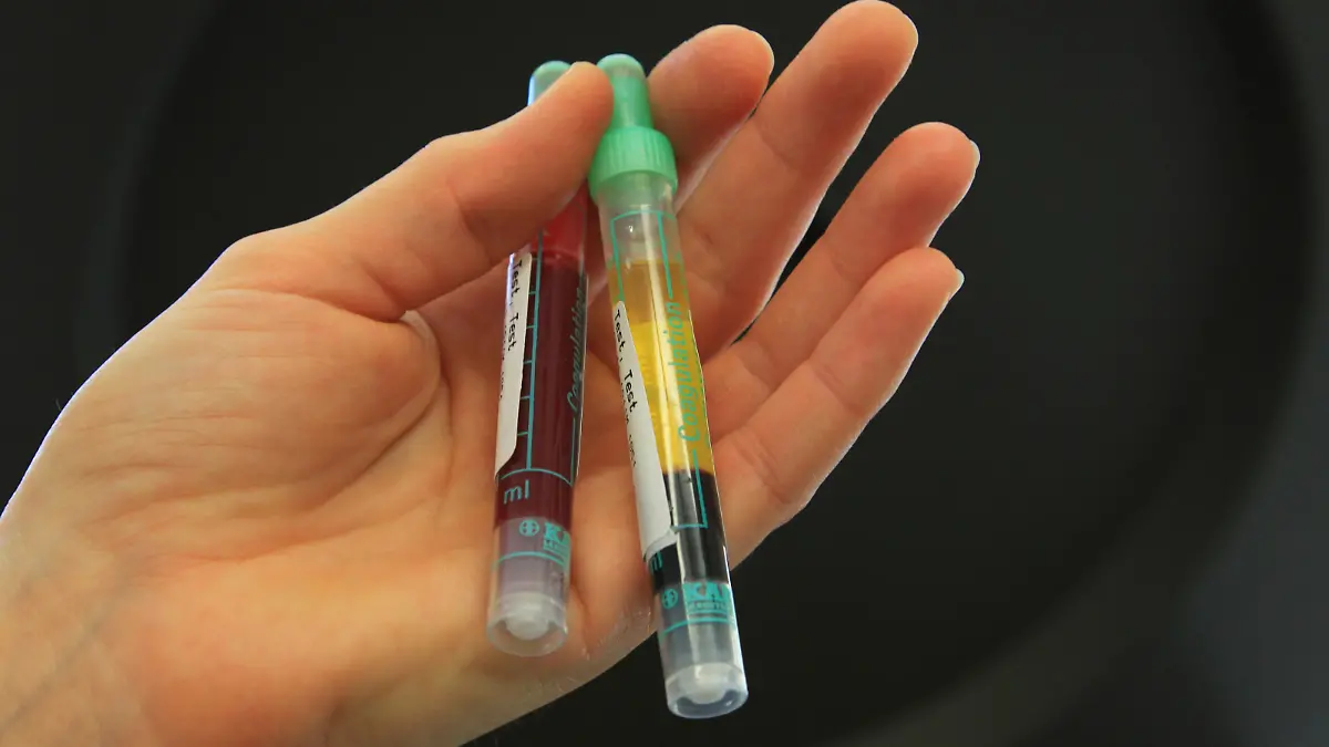Bluttest, Blut, Blutuntersuchung, Untersuchung, Krankenhaus, Klinik Keine Weitergabe an Drittverwerter.