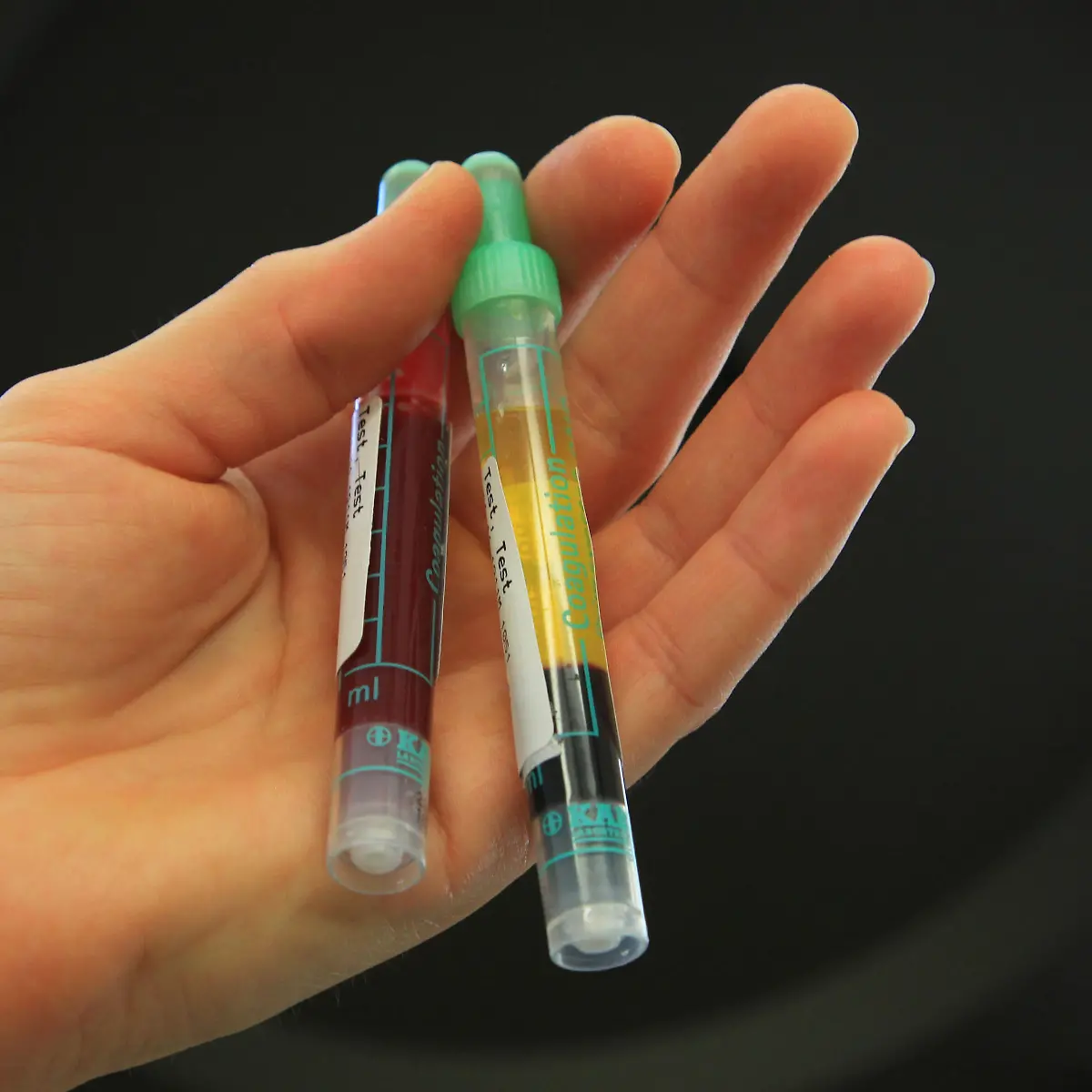 Lipase Logo von Lipase