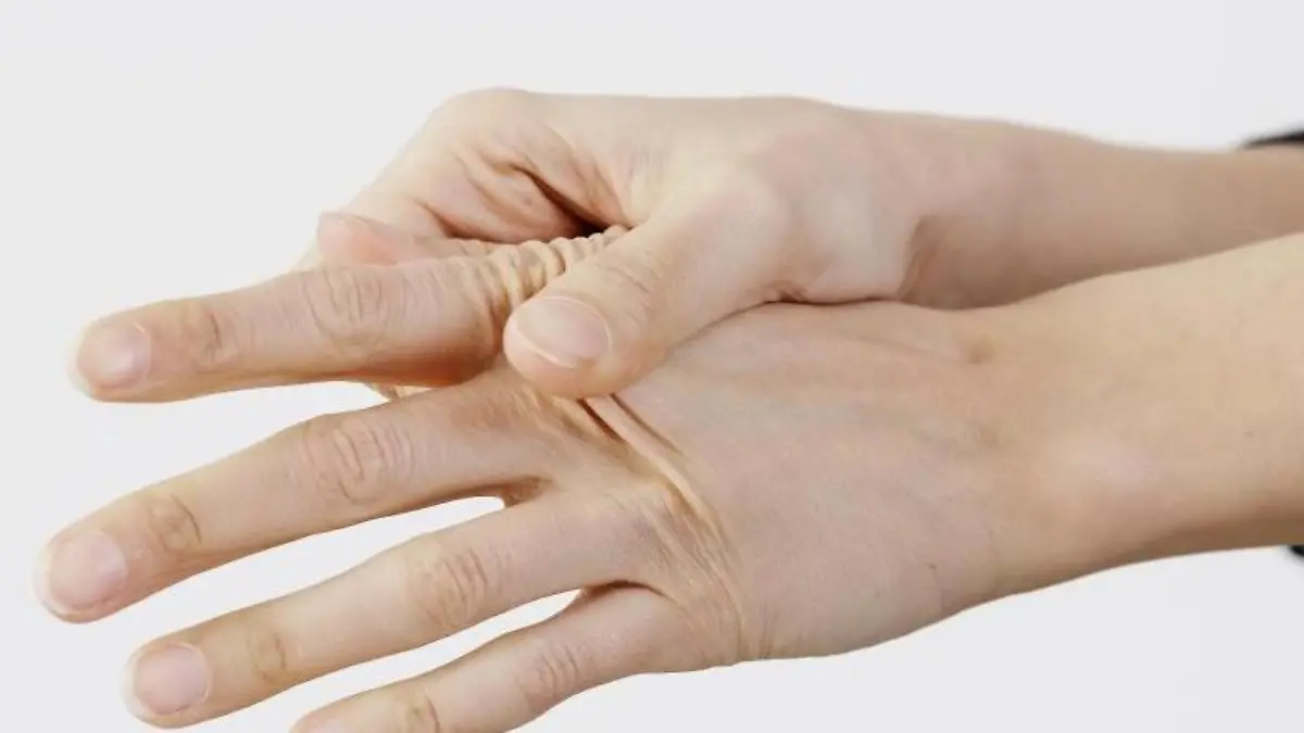 Erste Anzeichen für das Karpaltunnel-Syndrom sind kribbelnde oder taube Fingerkuppen. Dabei sind Daumen, Zeige- und Mittelfinger betroffen. Foto: Monique Wüstenhagen