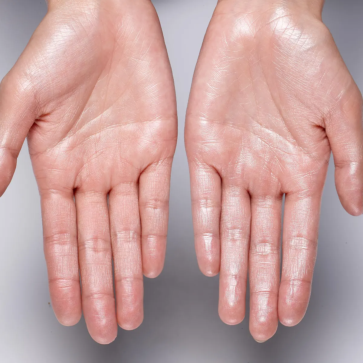 Hyperhidrose Logo von Hyperhidrose