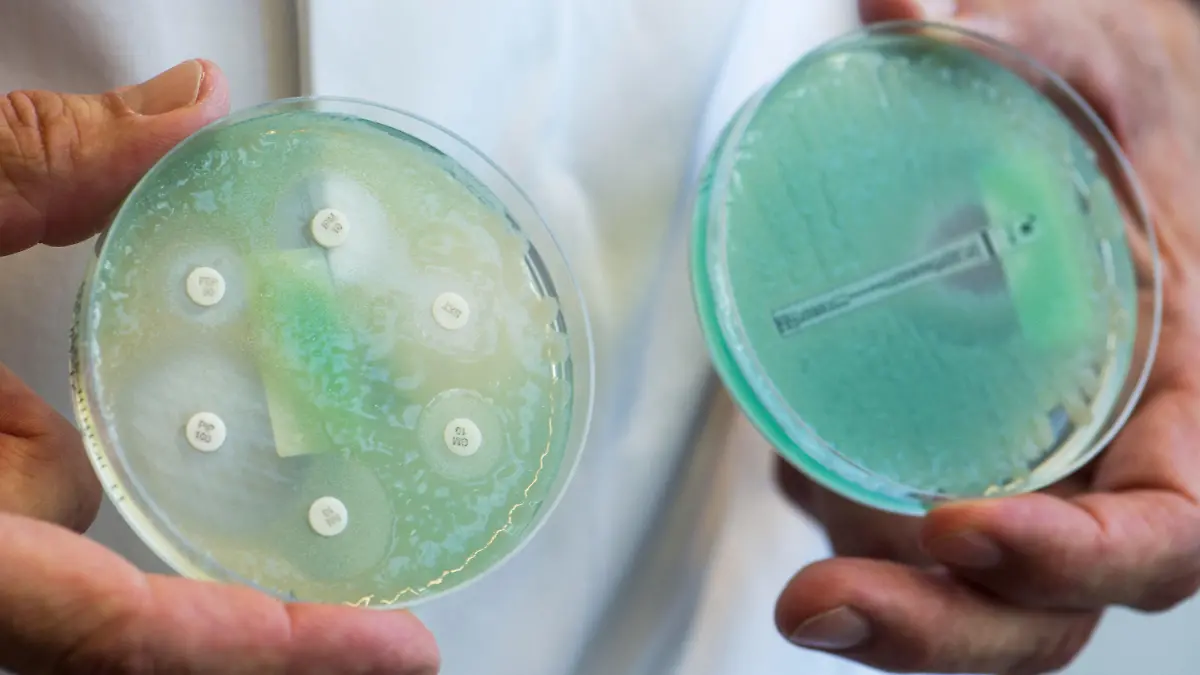 ARCHIV - 10.04.2017, Bayern, Regensburg: Petrischalen mit sogenannten Krankenhauskeimen, die Mehrfachresistenzen gegenüber Antibiotika aufweisen. (zu dpa "Test-Projekt: Antibiotikaverbrauch sinkt dank Info-Kampagne") Foto: Armin Weigel/dpa +++ dpa-Bildfunk +++