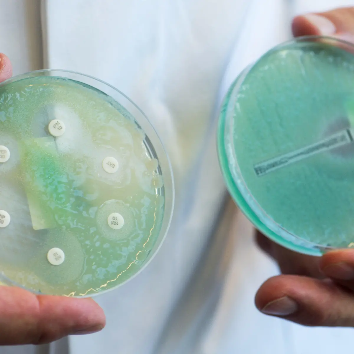 Pseudomonas aeruginosa Logo von Pseudomonas aeruginosa