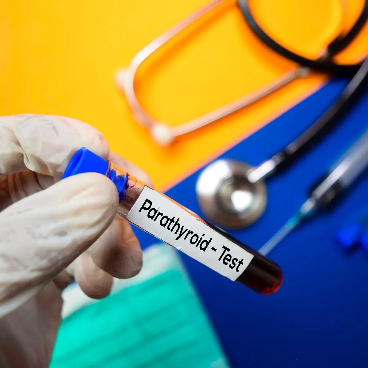 Parathormon (PTH, Parathyrin) Logo von Parathormon (PTH, Parathyrin)