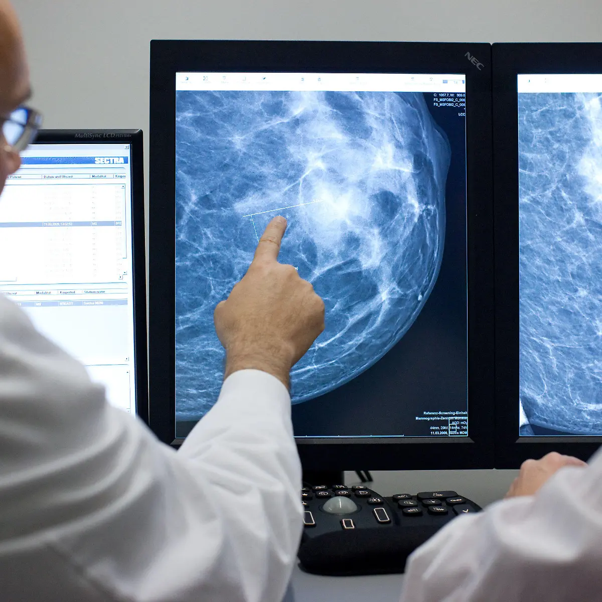 Rezidiv Logo von Rezidiv