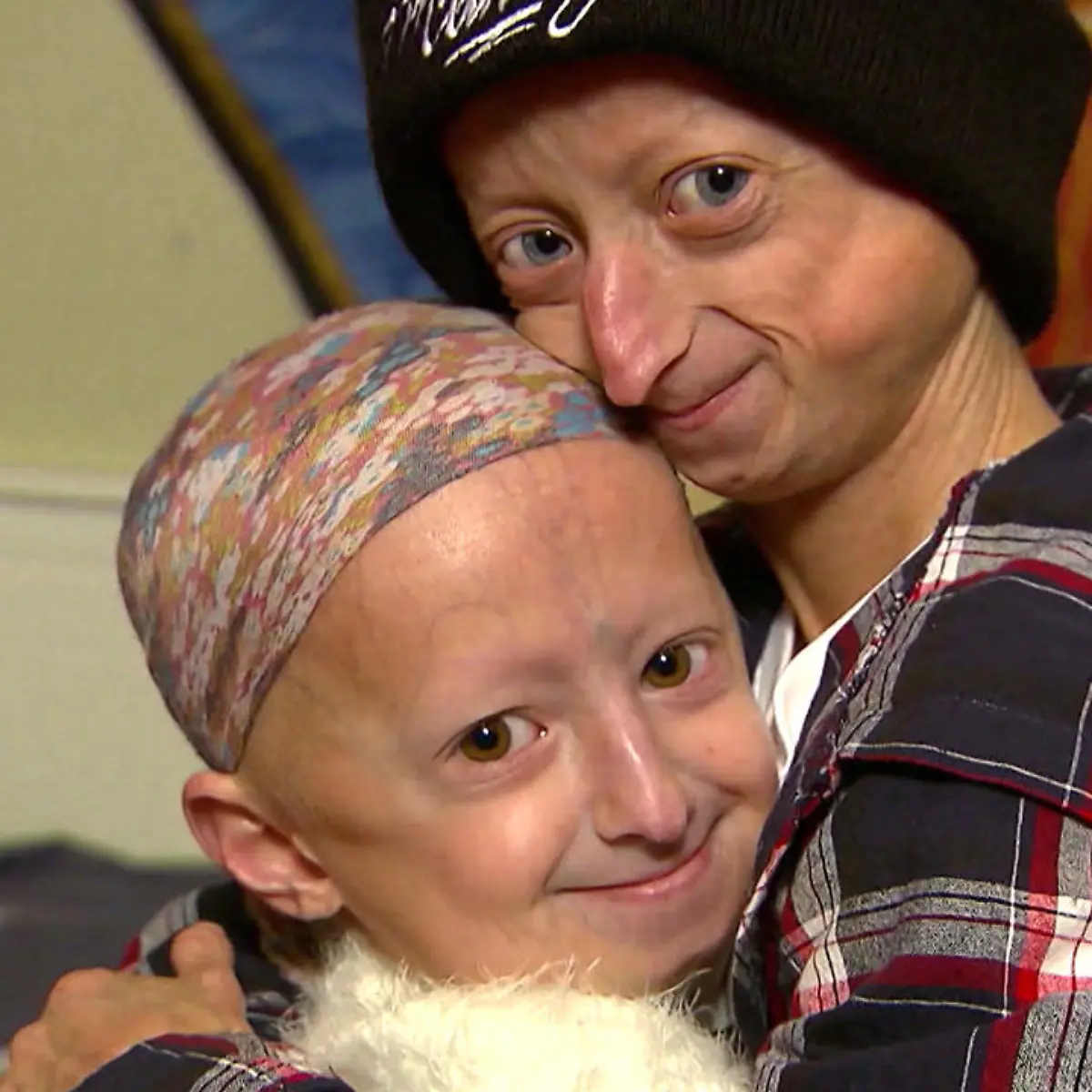 Progerie Logo von Progerie