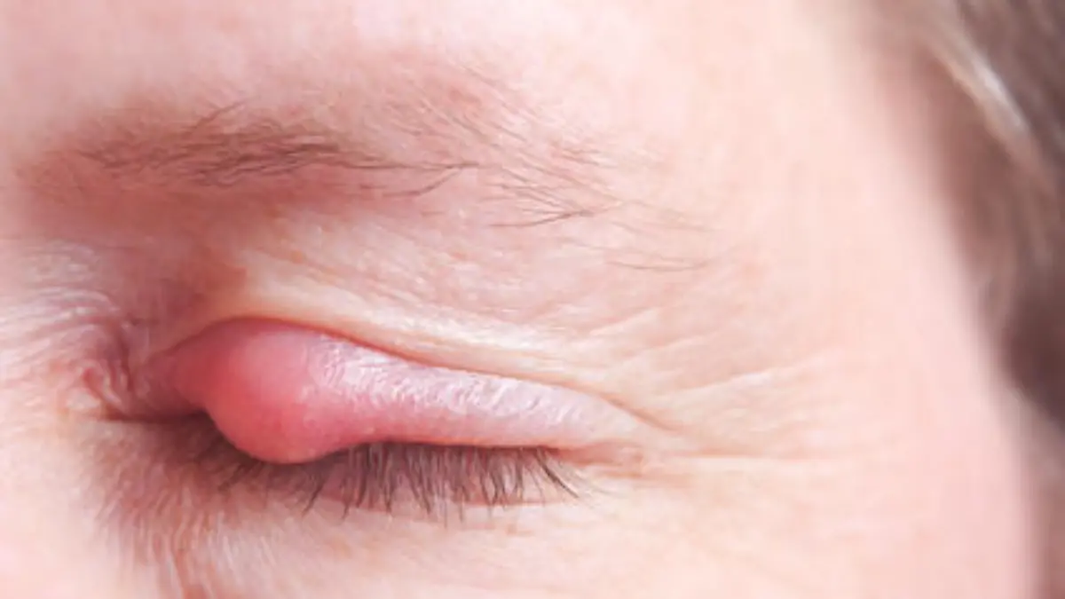 Fotolia 39330399 XS.jpg