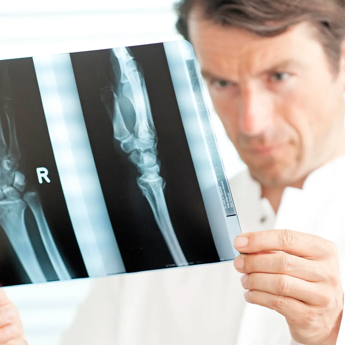 Fraktur (Knochenbruch) Logo von Fraktur (Knochenbruch)