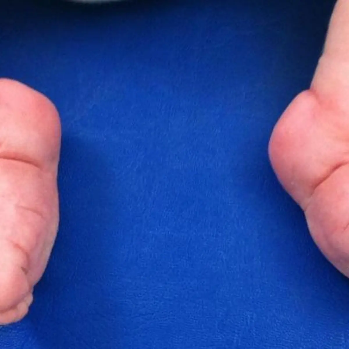 Klumpfuß Logo von Klumpfuß