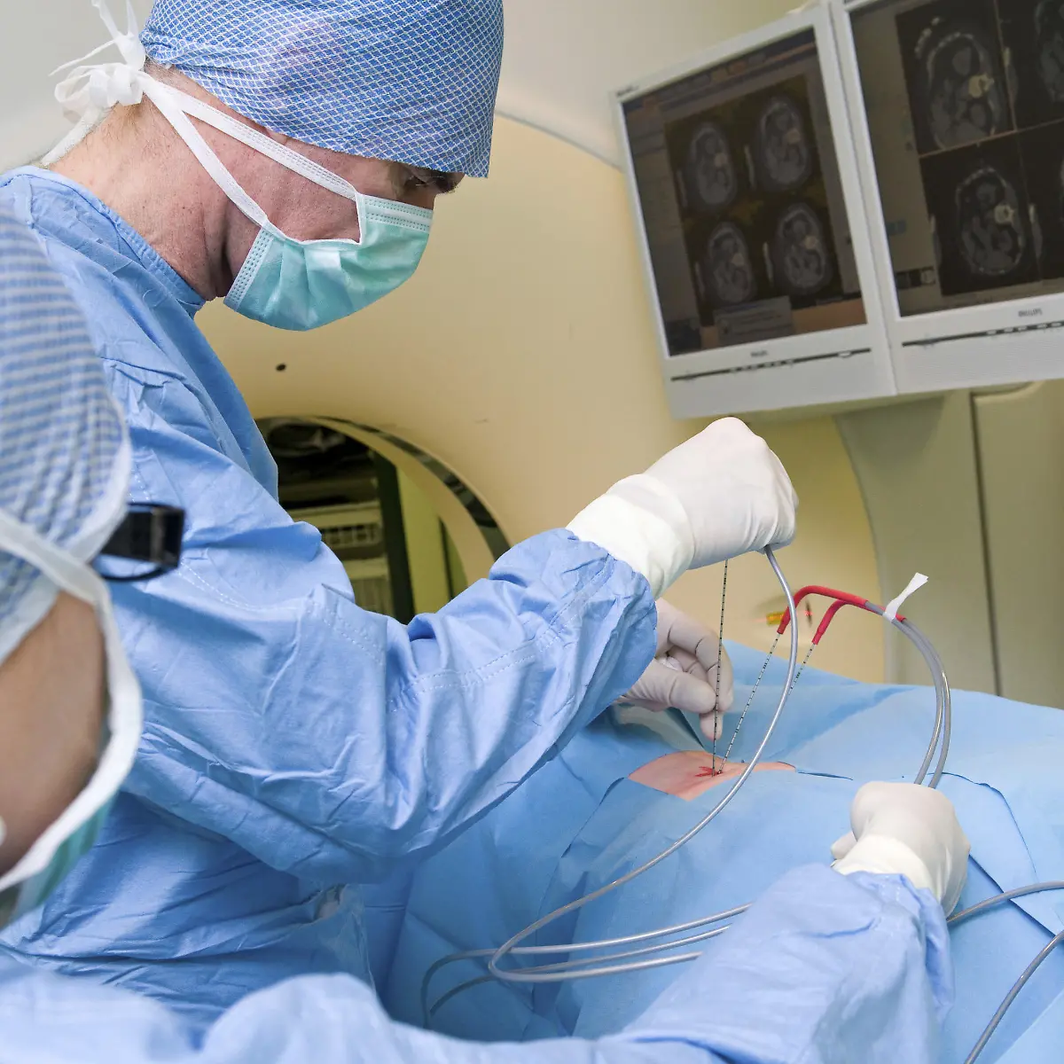 Nierenkrebs (maligner Nierentumor) Logo von Nierenkrebs (maligner Nierentumor)