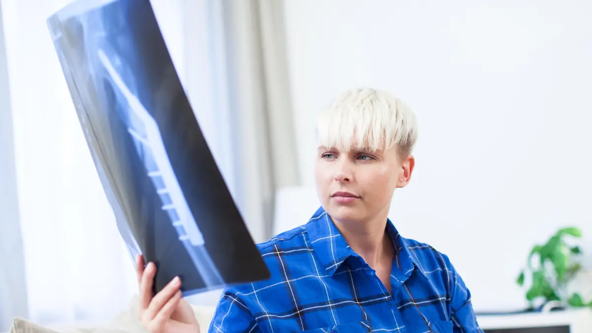 ILLUSTRATION - Eine Frau betrachtet am 07.09.2016 in einer Wohnung in Hamburg Roentgenbilder eines Oberschenkels an(gestellte Szene). Foto: Christin Klose | Verwendung weltweit