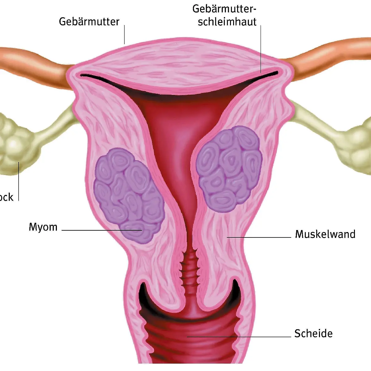 Zyste Logo von Zyste