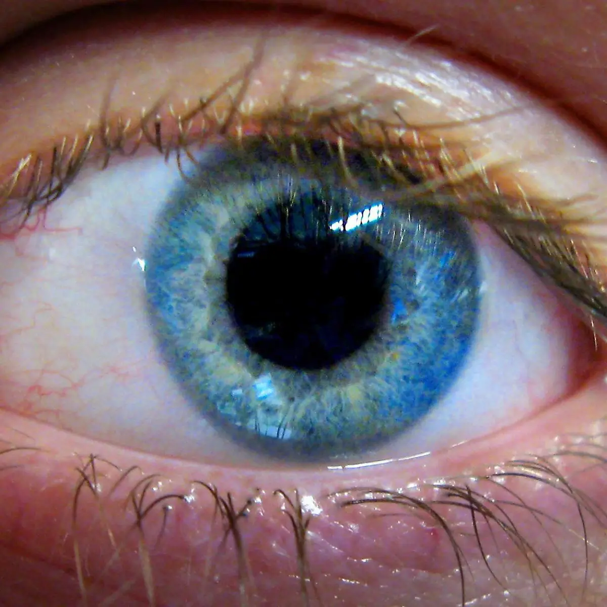 Serotonin-Syndrom Logo von Serotonin-Syndrom