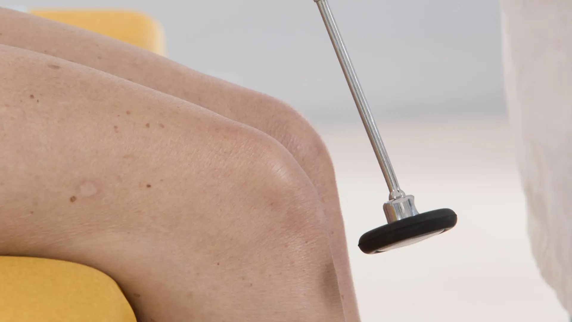 Ein Arzt prüft bei einer Patientin den Kniesehnenreflex
