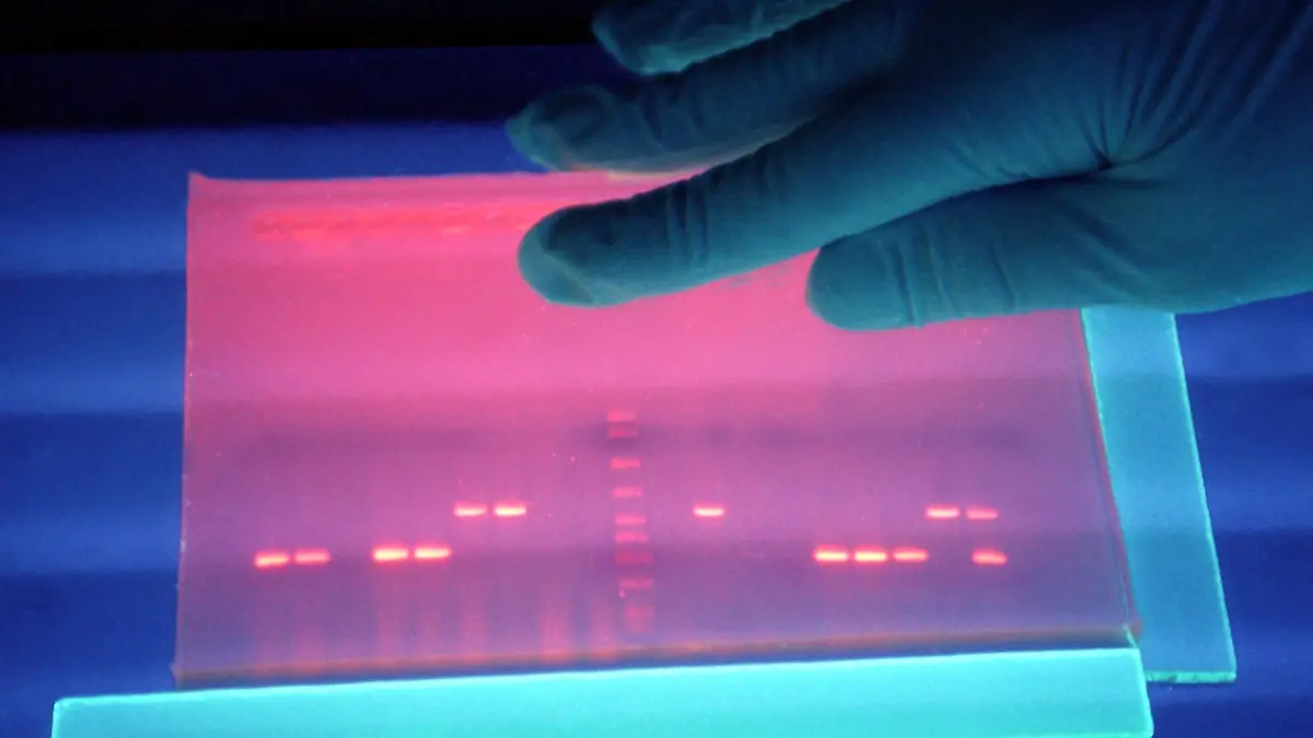 ARCHIV - Untersuchung von fluoreszierender DNS von EHEC-Bakterien in einem Labor in der Außenstelle Wernigerode (Sachsen-Anhalt) des Robert-Koch-Instituts (Archivbild vom 04.07.2001). In Hamburg haben sich mehrere Menschen mit dem lebensgefährlichen EHEC-Erreger infiziert. «Derzeit wissen wir von zwölf Fällen», sagte der Sprecher der Gesundheitsbehörde Rico Schmidt am Freitagabend (20.05.2011) der dpa. Betroffen seien Patienten aus allen Altersgruppen und ganz verschiedenen Bezirken.    Foto: Jens Kalaene dpa/lah (zu lno am 21.05.2011)  +++(c) dpa - Bildfunk+++