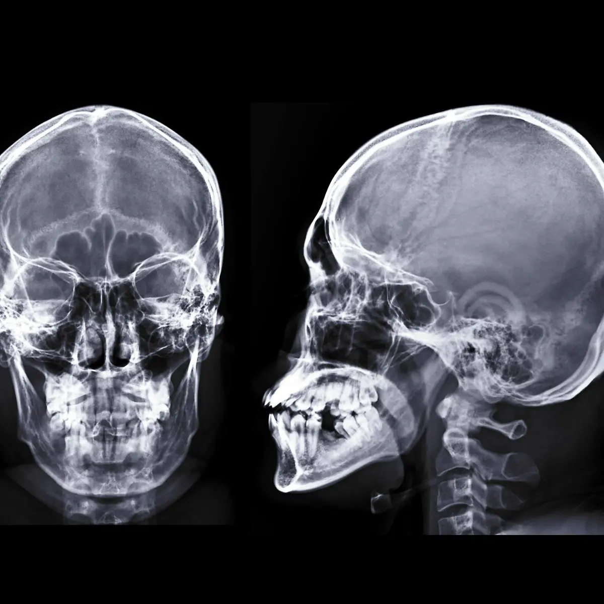 Schädel Logo von Schädel