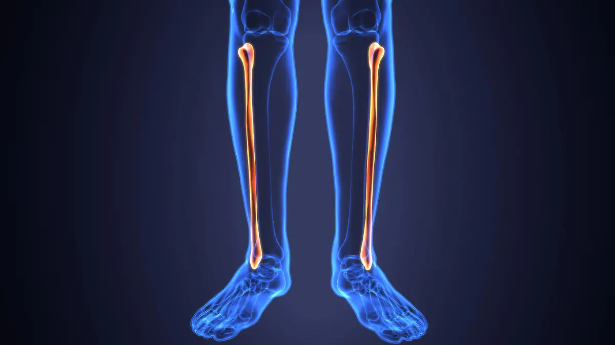 The fibula or calf bone is a leg bone located on the lateral side of the tibia, with which it is connected above and below. It is the smaller of the two bones, and, in proportion to its length, the slenderest of all the long bones. Its upper extremity is small, placed toward the back .