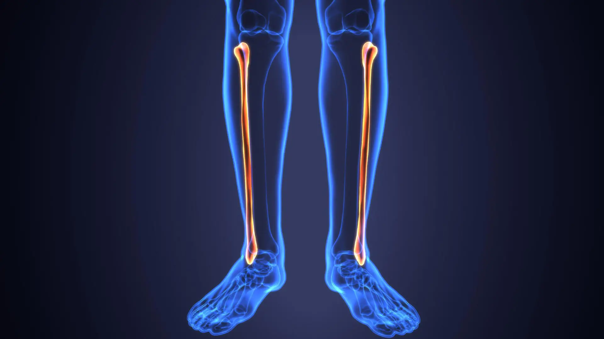 The fibula or calf bone is a leg bone located on the lateral side of the tibia, with which it is connected above and below. It is the smaller of the two bones, and, in proportion to its length, the slenderest of all the long bones. Its upper extremity is small, placed toward the back .
