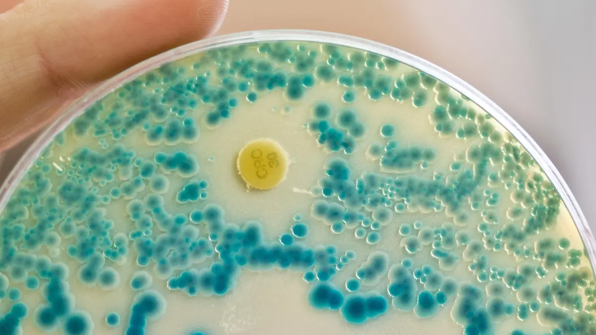 ARCHIV - 21.07.2015, Bayern, Erlangen: Eine Labormitarbeiterin am Institut für Klinische Mikrobiologie, Immunologie und Hygiene des Universitätsklinikums hält im Diagnostiklabor eine Indikator-Kulturplatte zum Nachweis von resistenten Bakterien in der Hand. (zu dpa "Antibiotika-resistente Keime in Gewässern: Experten besorgt" vom 06.02.2018) Foto: Daniel Karmann/dpa +++ dpa-Bildfunk +++