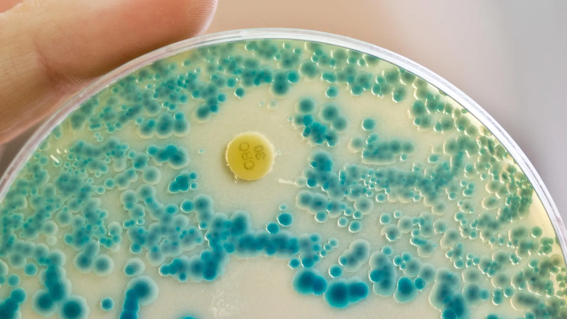 ARCHIV - 21.07.2015, Bayern, Erlangen: Eine Labormitarbeiterin am Institut für Klinische Mikrobiologie, Immunologie und Hygiene des Universitätsklinikums hält im Diagnostiklabor eine Indikator-Kulturplatte zum Nachweis von resistenten Bakterien in der Hand. (zu dpa "Antibiotika-resistente Keime in Gewässern: Experten besorgt" vom 06.02.2018) Foto: Daniel Karmann/dpa +++ dpa-Bildfunk +++