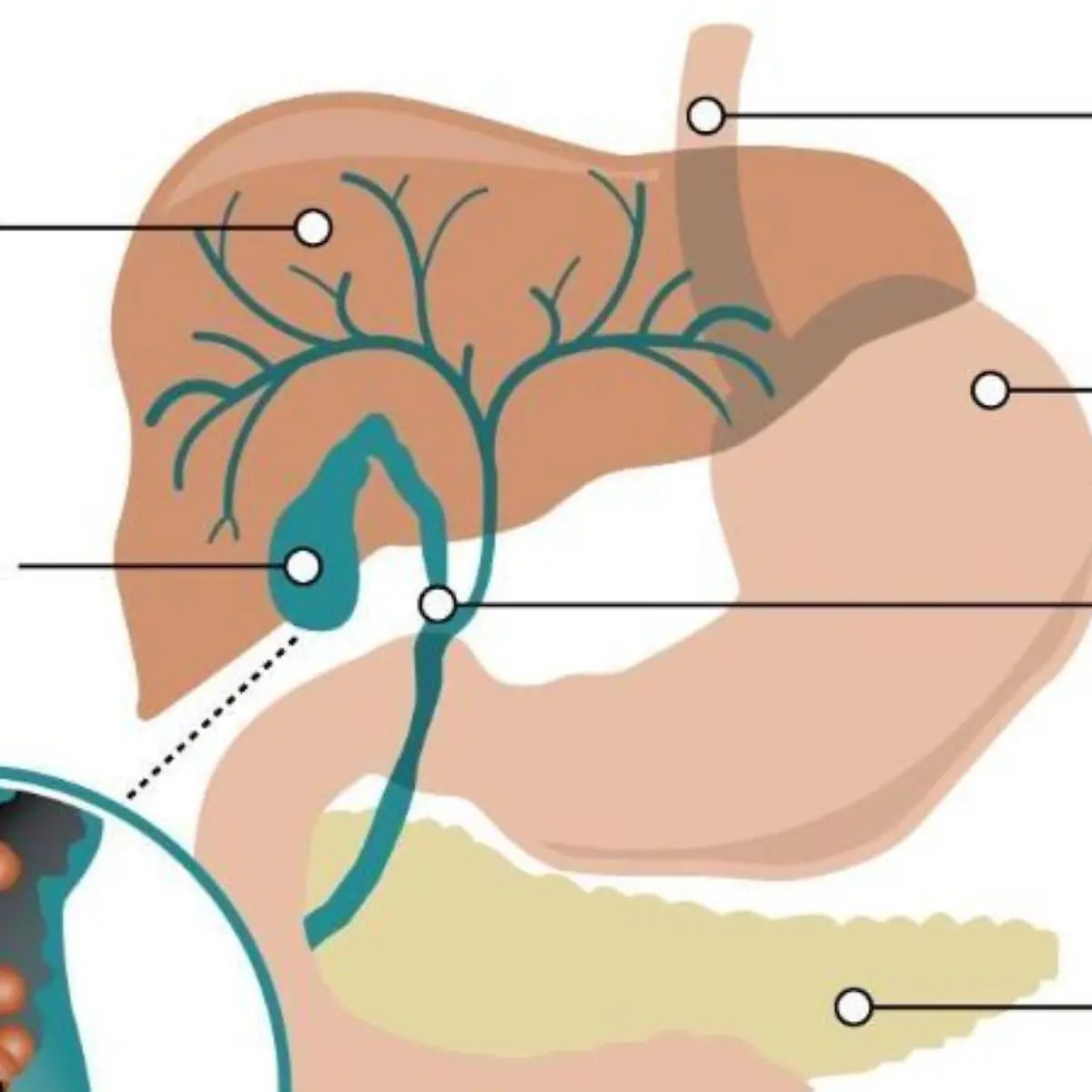 Cholezystektomie Logo von Cholezystektomie