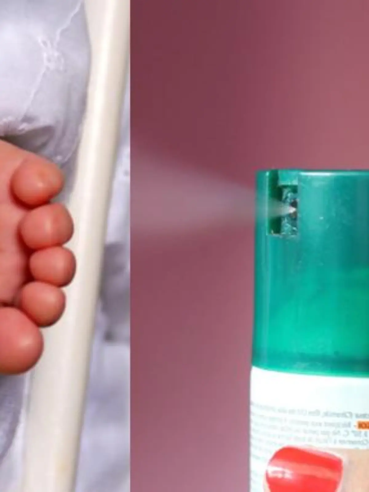 Über Monate hat eine 29-jährige Italienerin den Körper ihrer erst 17 Monate alten Tochter mit Deo besprüht. Die Folgen waren Hautausschläge, Verkrustungen und offene Schürfwunden am ganzen Körper.