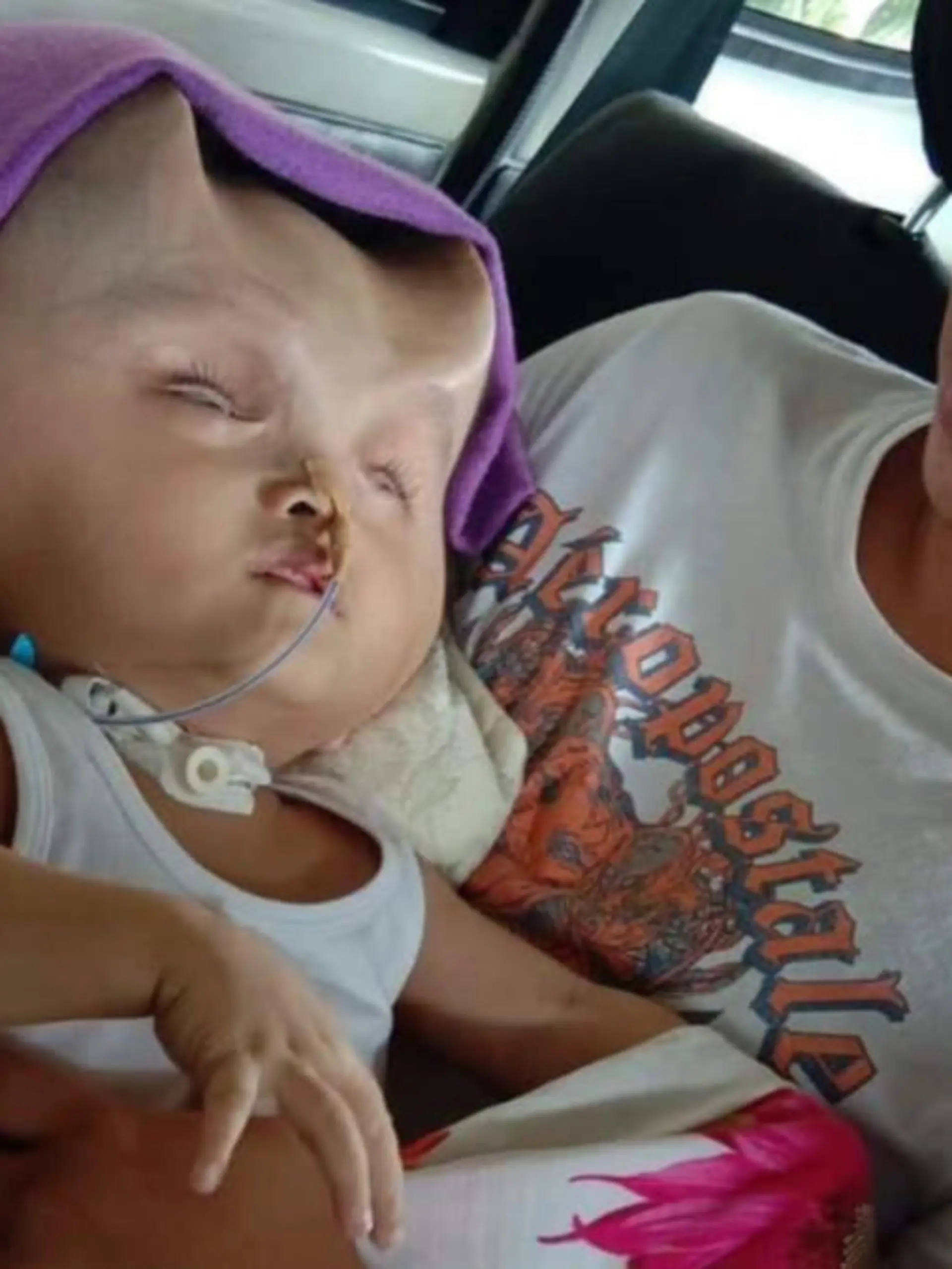 Clyne Solano leidet an Hydranencephalie, einer schweren Fehlbildung des Gehirns.