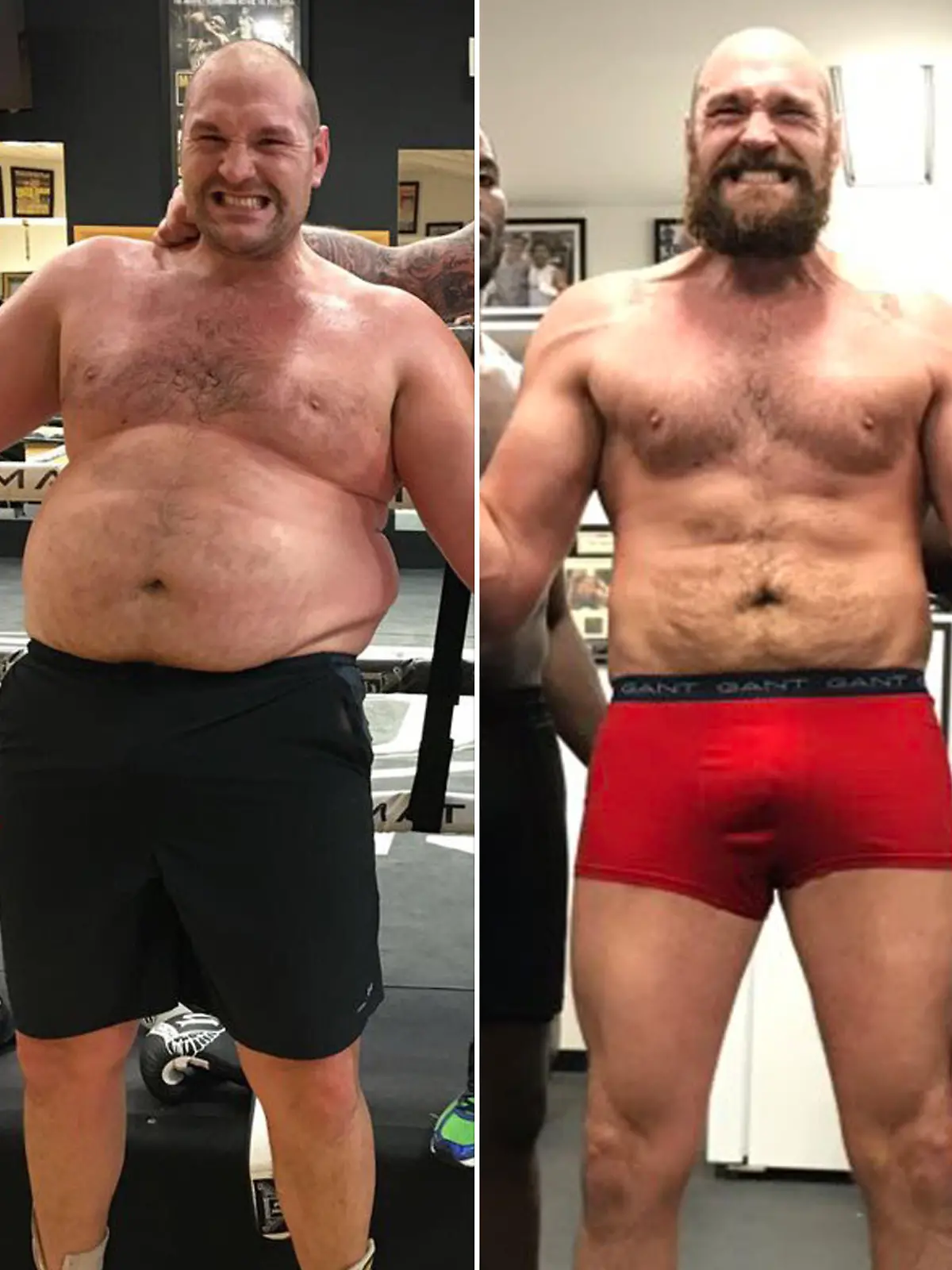 Tyson Fury 2017 vs Tyson Fury 2018