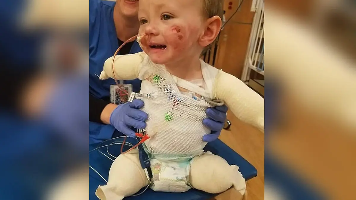Trotz des schweren Schicksalsschlages: Der kleine Jeremiah verliert sein Lächeln nicht.