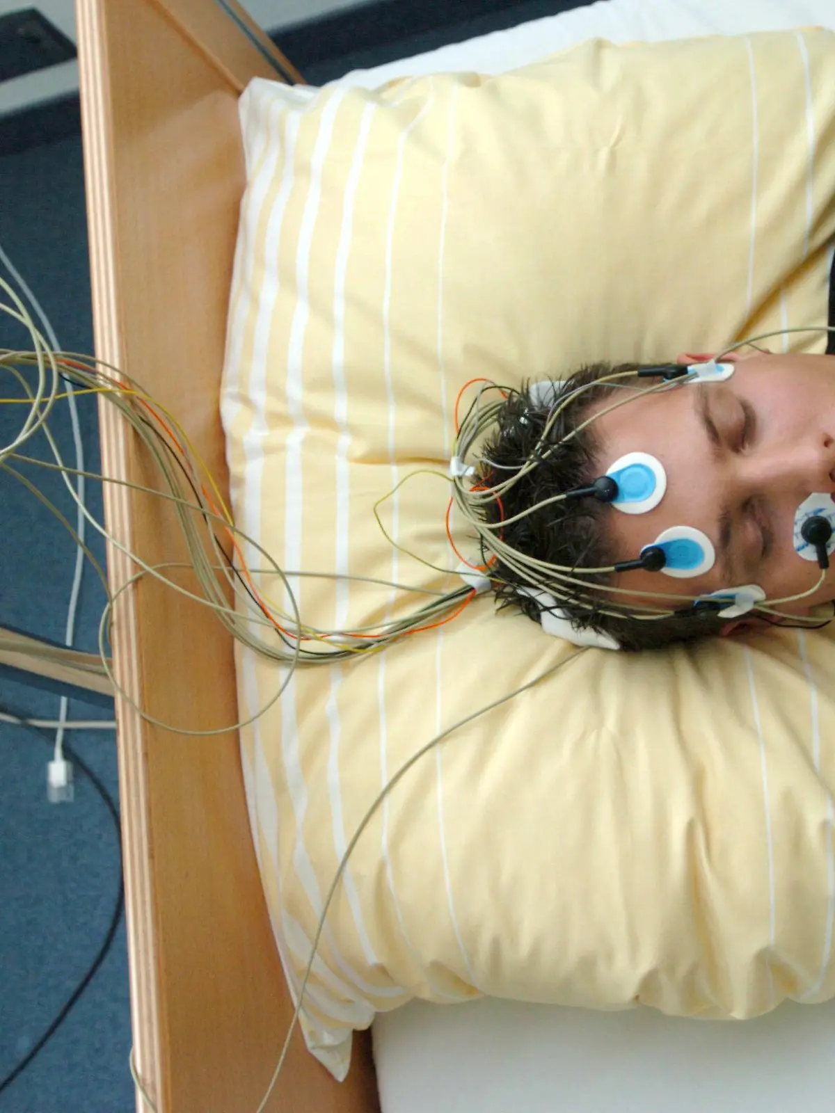 ARCHIV - Ein Patient des Schlaflabors der Universitätsklinik Freiburg liegt, am Kopf mit Elektroden bestückt, in einem Bett der Einrichtung (Archivoto vom 22.09.2004). Kabel leiten die gemessenen Hirnströme an ein Aufzeichnungsgerät weiter. Laut Deutscher Gesellschaft für Schlafforschung und Schlafmedizin leiden rund fünf Prozent der Bevölkerung unter ernsten und behandlungsbdürftigen Schlafstörungen. Foto: Rolf Haid dpa/lnw (zu lnw-KORR: " Wenn Schlaf zum Albtraum wird" vom 10.07.2006)  +++(c) dpa - Bildfunk+++