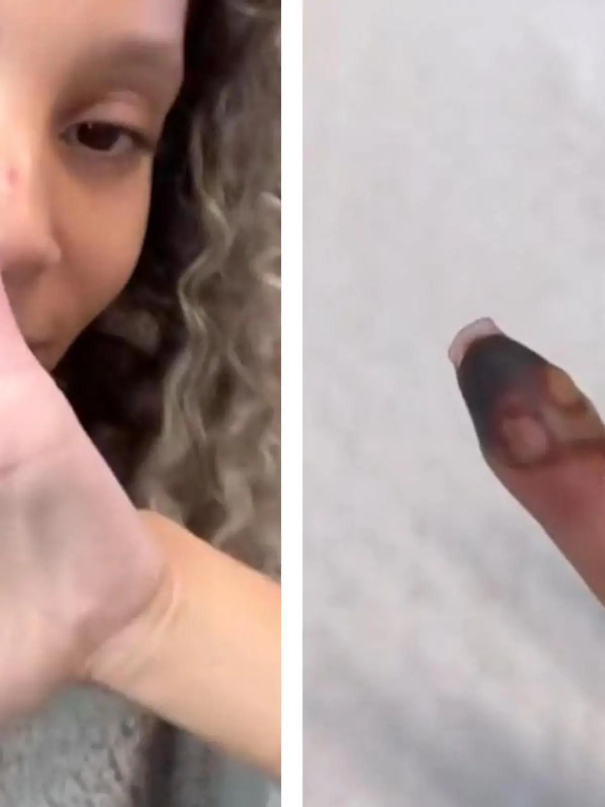 Eigentlich wollte sie zuhause nur ihre Nägel machen - jetzt ist ihr kleiner Finger abgestorben! Shawna Lae aus den USA wollte ihre Tochter nach Disney World begleiten, als ihr Nagel abgebrochen ist. Etwas Sekundenkleber sollte das Problem schnell lösen - im Endeffekt fingen damit die Probleme aber erst an.