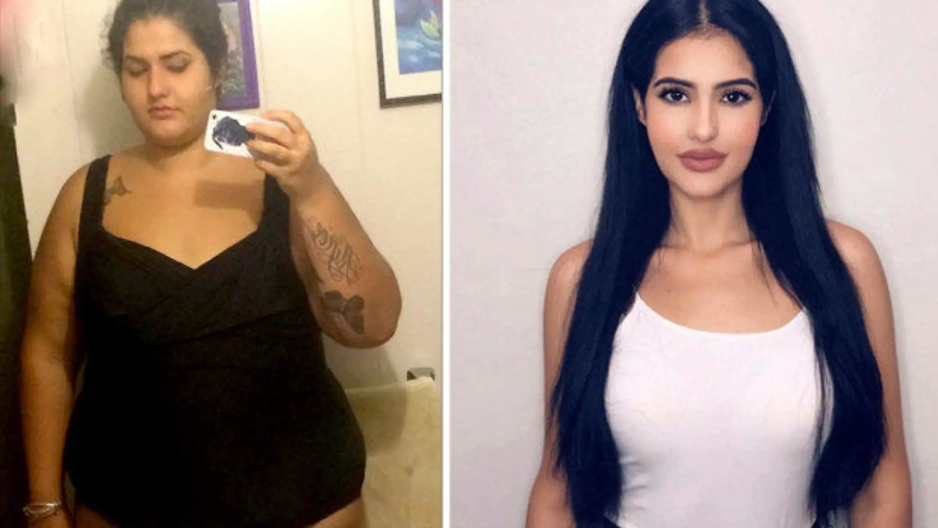 Shantel Carrillo aus San Diego vor und nach ihrer Magenverkleinerung.
