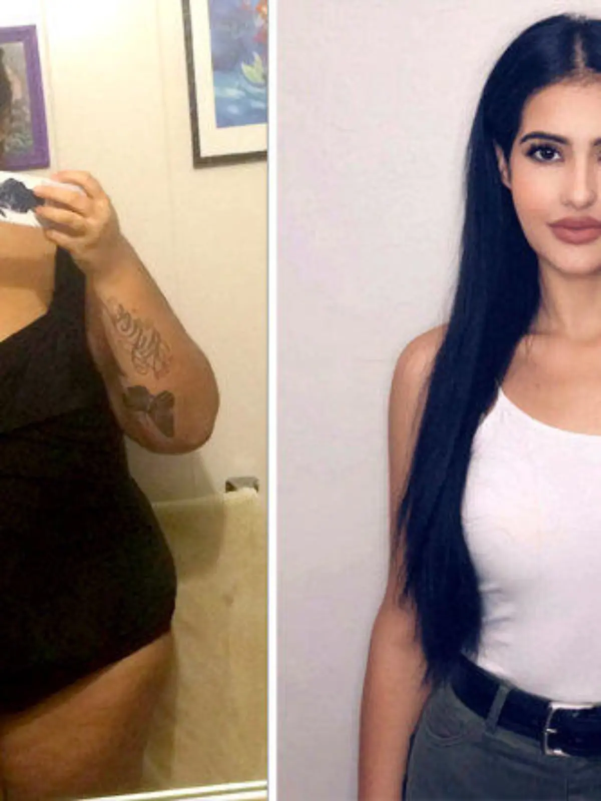 Shantel Carrillo aus San Diego vor und nach ihrer Magenverkleinerung.