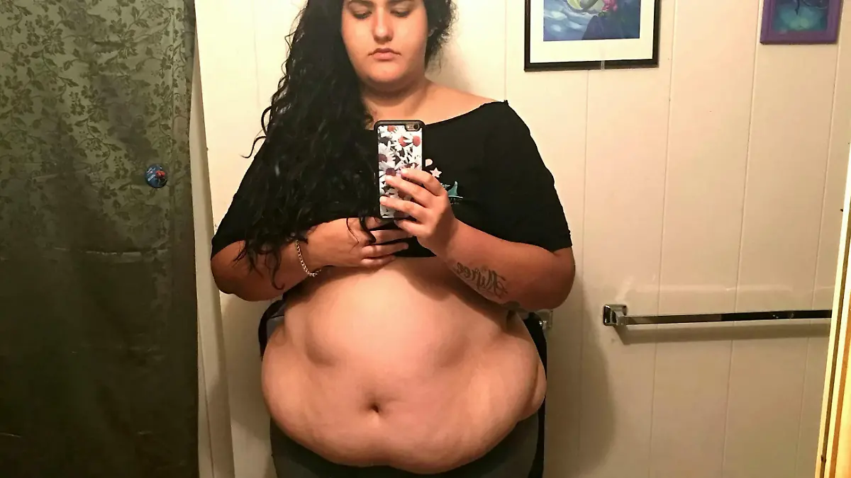Shantel Carrillo aus San Diego, Kalifornien vor ihrer Magenverkleinerung
