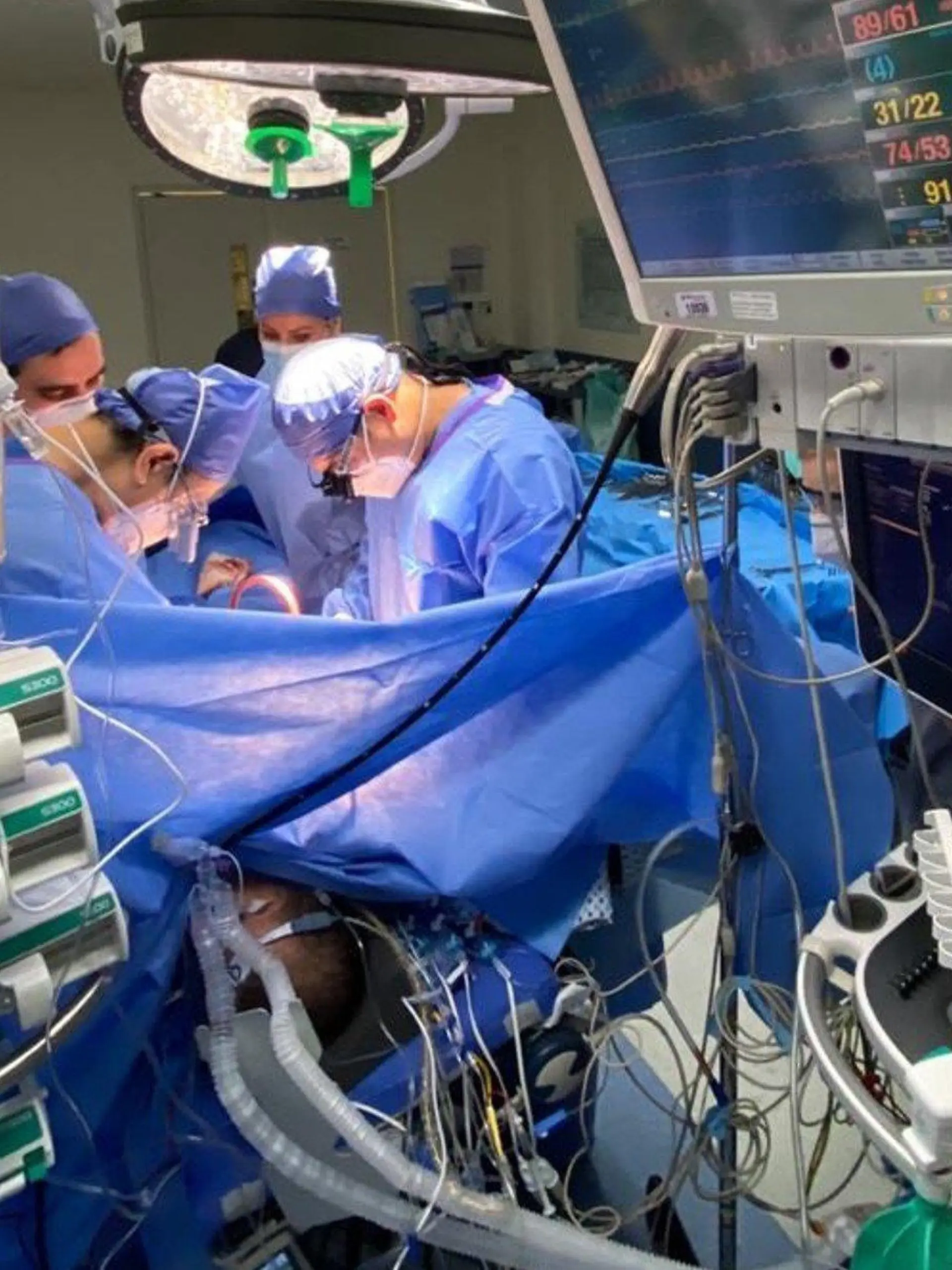 HANDOUT - 31.08.2020, Mexiko, Monterrey: Auf diesem vom Krankenhaus Christus Muguerza zur Verfügung gestellten Bild führt ein Team um den Chirurgen Wong Jaen eine Doppel-Lungentransplatation an einem Covid-19-Überlebenden durch. Der 55-jährige Patient war zuvor 52 Tage lang künstlich beatmet worden. (Wiederholung mit verändertem Bildausschnitt) Foto: ---/Hospital Christus Muguerza/dpa - ACHTUNG: Nur zur redaktionellen Verwendung im Zusammenhang mit der aktuellen Berichterstattung und nur mit vollständiger Nennung des vorstehenden Credits +++ dpa-Bildfunk +++